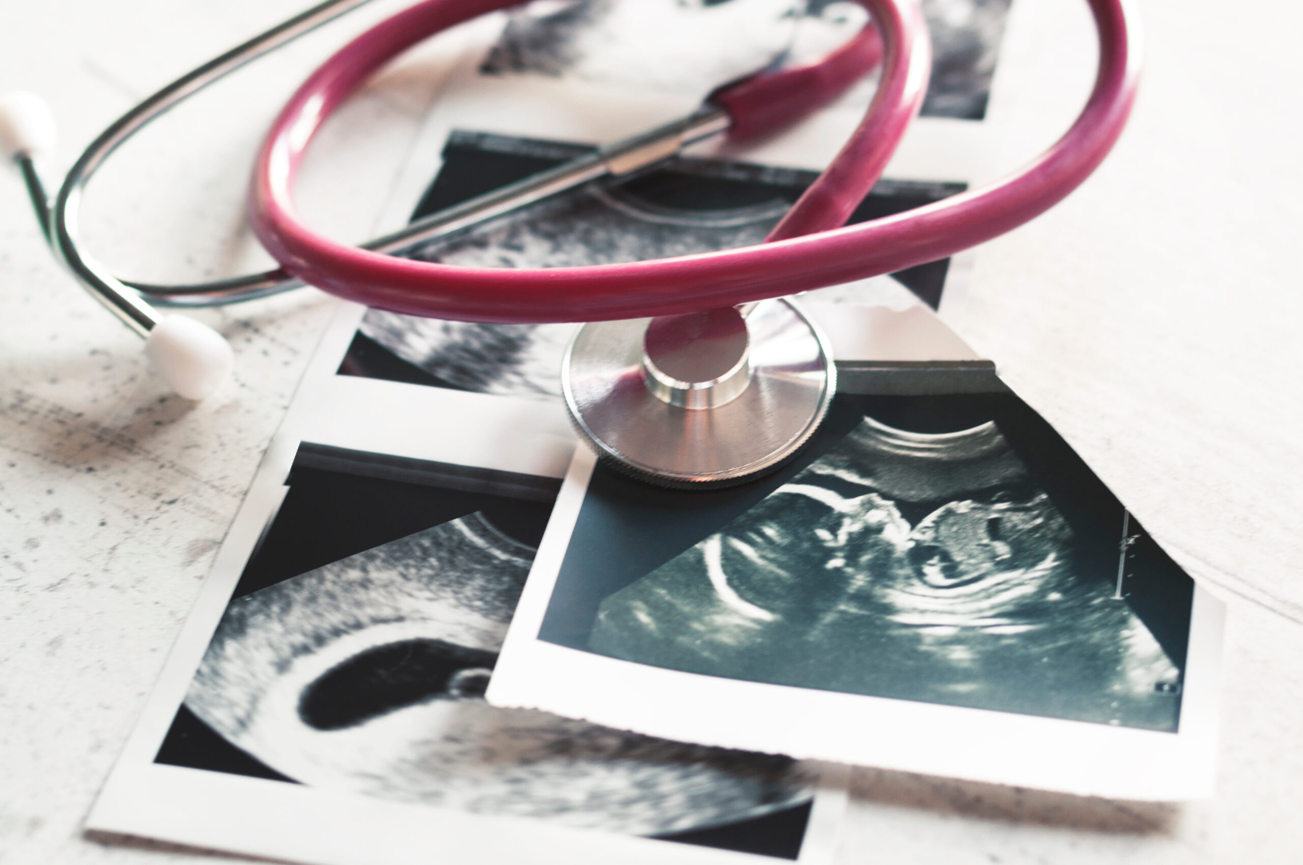 In the pictures of the ultrasound 4 weeks of pregnancy and 20 weeks is a phonendoscope. The concept of the study of pregnancy. Observation Selective focus.