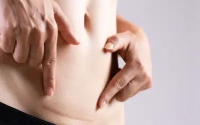 Planning for the Unexpected: Indications for a Cesarean Delivery